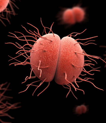 Un caso di gonorrea resistente alle cure abituali preoccupa le autorità britanniche